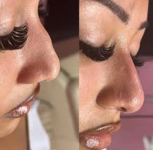 Load image into Gallery viewer, Group Full Facial Balancing & Body Fillers Duo Course