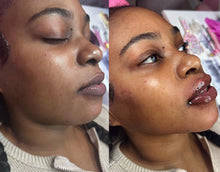 Load image into Gallery viewer, Group Full Facial Balancing & Body Fillers Duo Course