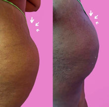 Load image into Gallery viewer, Group Full Facial Balancing & Body Fillers Duo Course