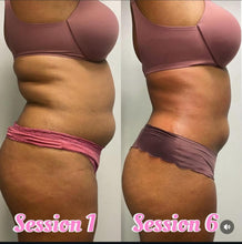 Load image into Gallery viewer, Liquid Lipo/Meso Theapry Sessions