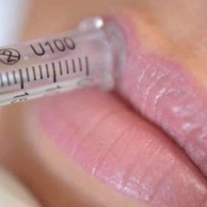 What is Hyaluron Lip Filler