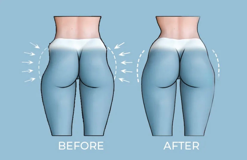 NON-SURGICAL BUTT LIFT, BODY CONTOURING, CELLULITES