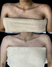 Load image into Gallery viewer, At-Home Chemical Peel
