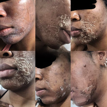 Load image into Gallery viewer, At-Home Chemical Peel
