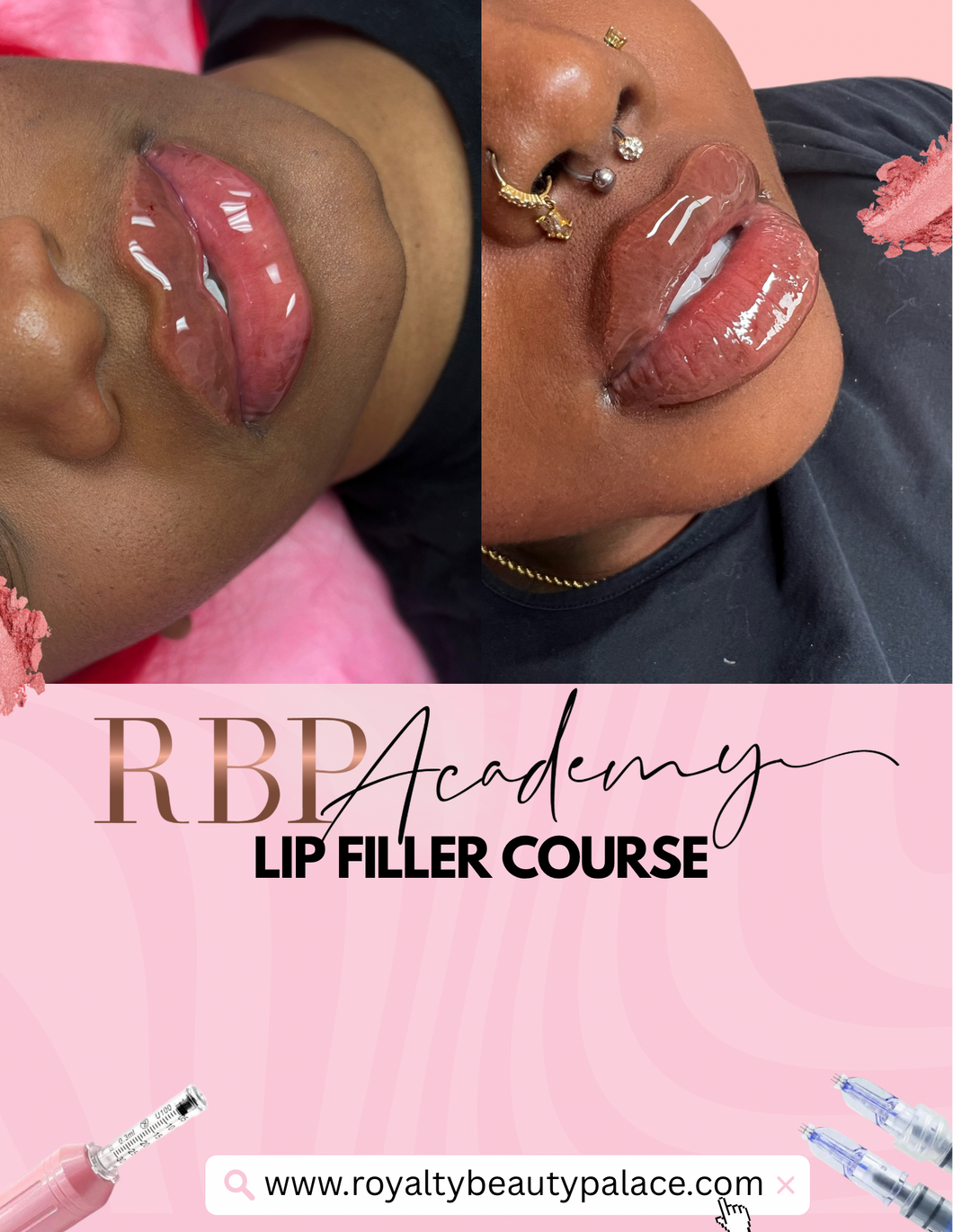 Hyaluron Pen Lip Course