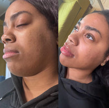 Load image into Gallery viewer, Group Full Facial Balancing &amp; Body Fillers Duo Course
