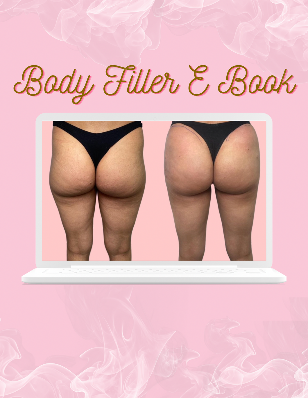 Body Fillers E-book